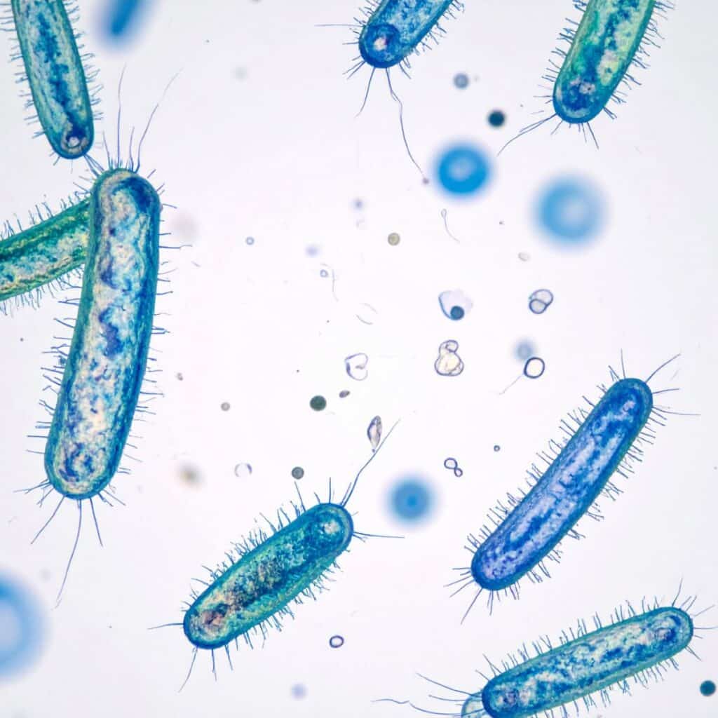 7 Common Ways Bacteria Gets Into a Well